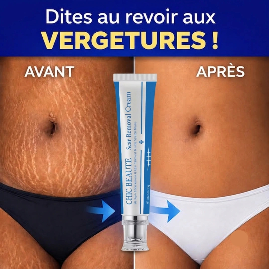 Crème réparatrice anti-cicatrices et vergetures - VivaLok™