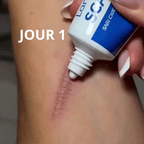 Crème réparatrice anti-cicatrices et vergetures - VivaLok™
