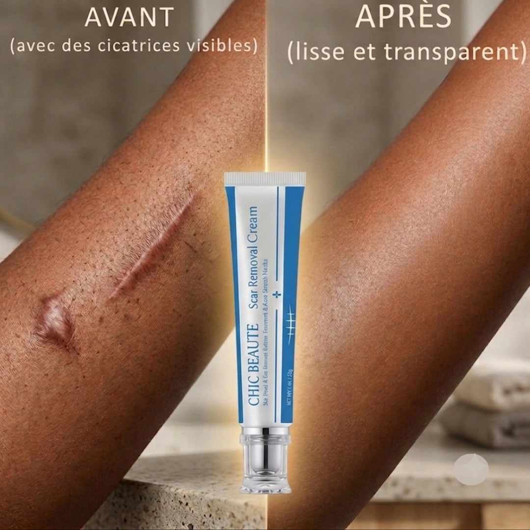 Crème réparatrice anti-cicatrices et vergetures - VivaLok™